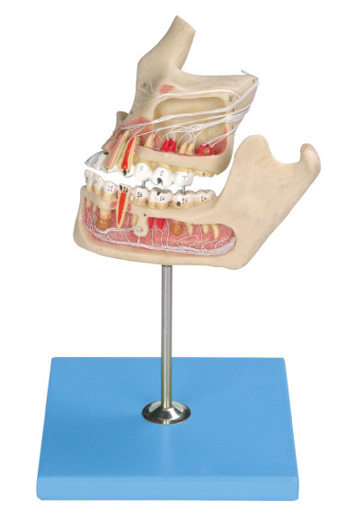 Modello umano patologico dei denti/modello della mandibola con colore che corrisponde dal computer circa due parti
