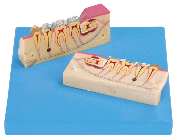 12 posizioni sono visualizzate del modello Dissected del tessuto dei denti