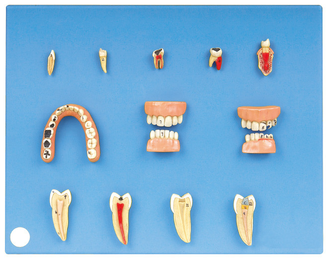 Modello dentario di malattie fatto del PVC avanzato per internato e la formazione degli studenti