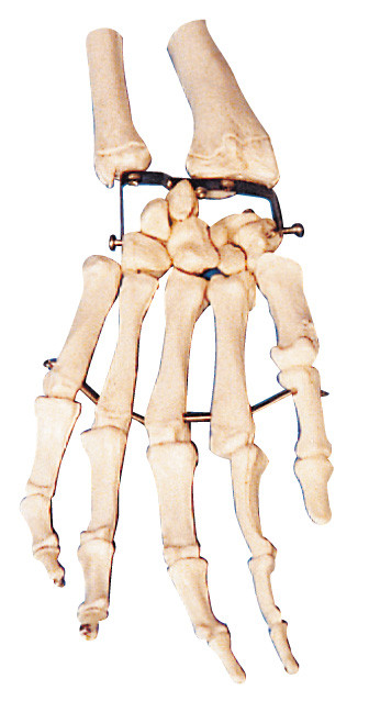 Modello formativo umano del modello di anatomia dell'osso della palma per la facoltà di medicina