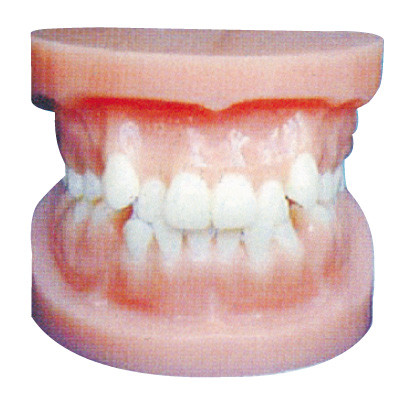 L'impianto dentario modella/modello ortodontico per addestramento anatomico