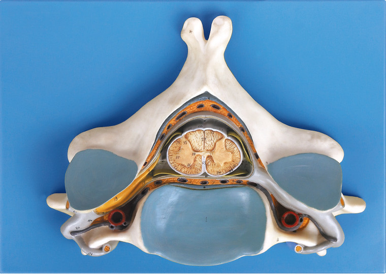 Quinto Vertrebra cervicale con il modello di scheletro umano anatomico del nervo e del midollo spinale