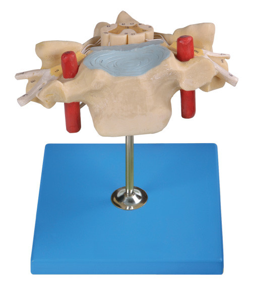 Vertrebra cervicale con il modello umano dell'anatomia del midollo spinale mostra l'arteria spinale, la vena, nervo