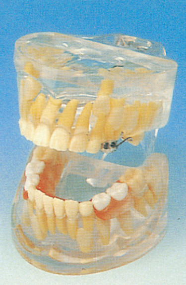 Modello umano dei denti delle scuole dentarie/modello trasparente di sviluppo di denti del latte
