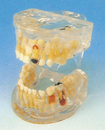 Il modello umano dei denti/patologia lucida dei denti di latte modella per la formazione delle scuole dentarie