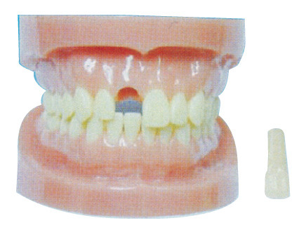 Modello staccabile dei denti senza radice per gli ospedali e l'addestramento dentario di prevenzione