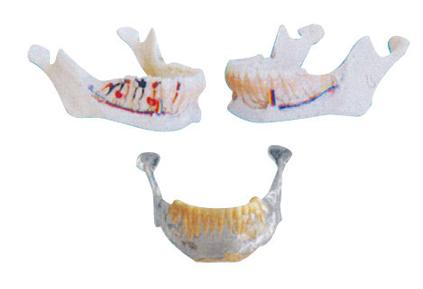 I denti del dentista modellano il modello mandibolare con i nervi, le arterie e le vene
