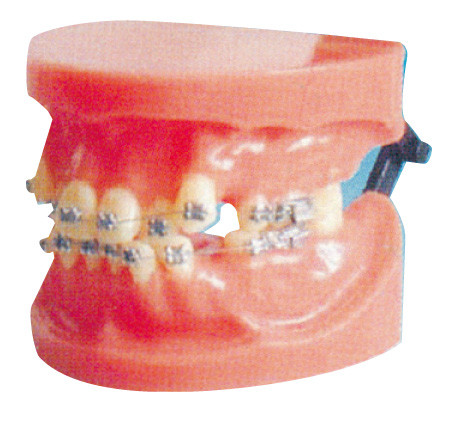 Modello ortodontico fisso di dislocazione per l'istituto universitario medico e l'addestramento dentario dell'ospedale